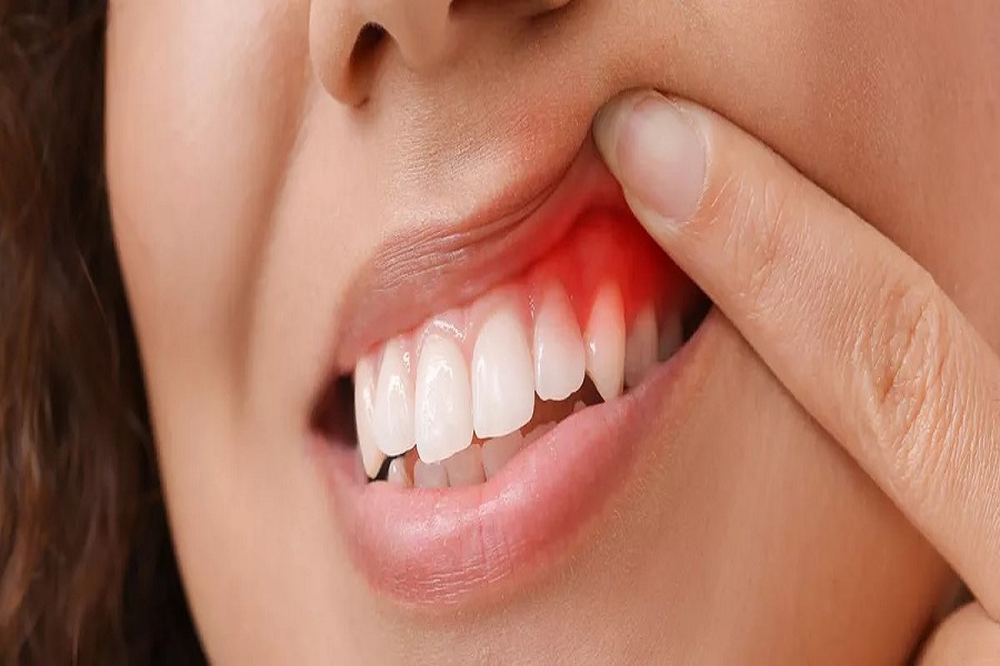 Periodontoloji Uygulaması